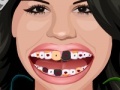Игра Selena Gomez Perfect Teeth 