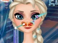 Игра Frozen Elsa Nose Doctor