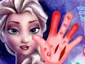 Игра Frozen. Hand surgery
