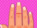 Игра Finger surgery