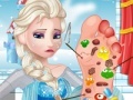 Игра Elsa foot doctor