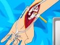 Игра Arm surgery 2
