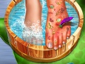 Ігра Feet Skin Doctor