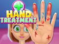 Ігра Hand Treatment